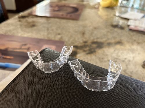 Customer photo review of Upper and Lower Retainers Set