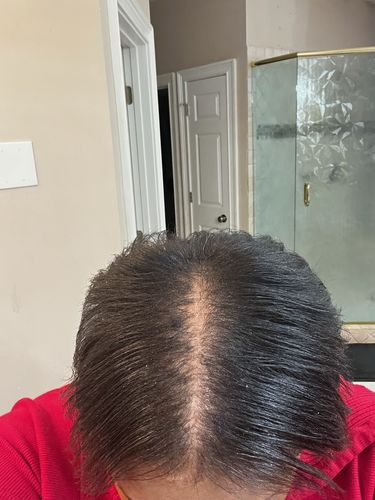 Customer photo review of CAFFEINE HAIR GROWTH BUTTER