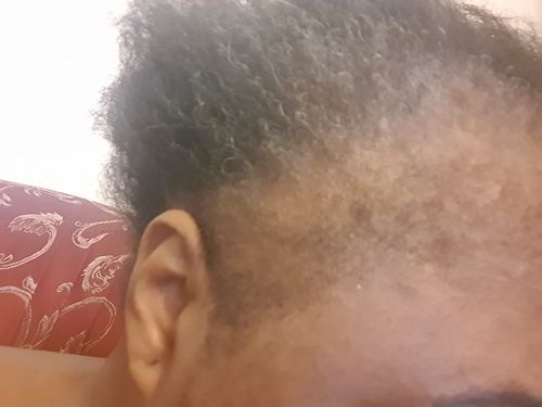 Customer photo review of Good Hair Vitamins - Abonnement 3 mois 10%