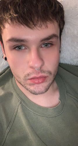 Customer photo review of Vegas Girl Contact Lenses(12 months of use)