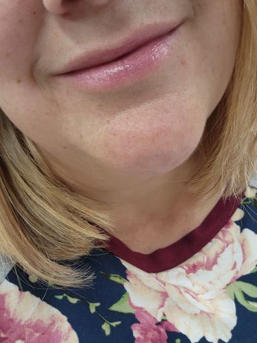 Customer photo review of Little Smooch (2) - 20% OFF