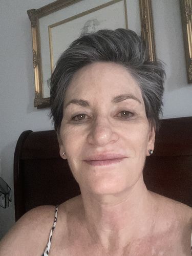 Customer photo review of Buy a Caviar Face Cream, Get a Free Vitamin C Serum