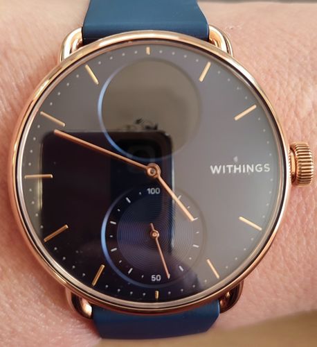 Kundenbewertung mit Foto zu Withings ScanWatch
