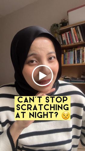 Customer video review of Eczema Scratch Mitten