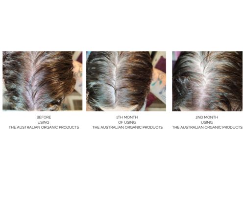 Customer photo review of Scalp Care With Argan Oil - 10 Minute Miracle - Mega Bundle