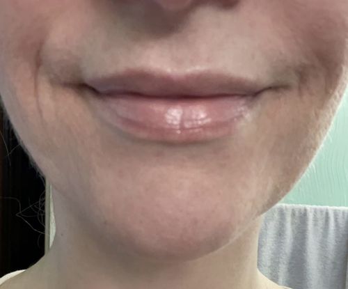 Customer photo review of LA LA LIPs