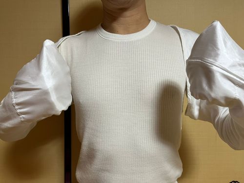 Customer photo review of Eczema Scratch Mitten