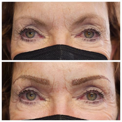 Customer photo review of 12C 0.18MM Nano - Flexi Blade