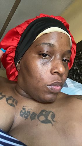 Customer photo review of Hydrating Turmeric Jelly Mask