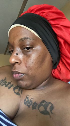 Customer photo review of Turmeric Minis