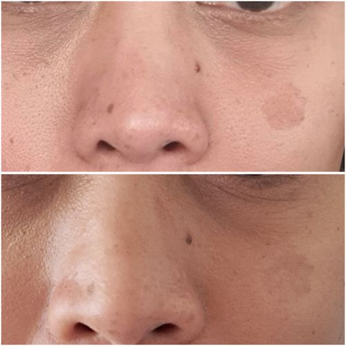 Customer photo review of Vitamin C serum