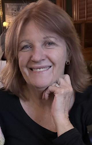 Customer photo review of Flexible Partial Denture