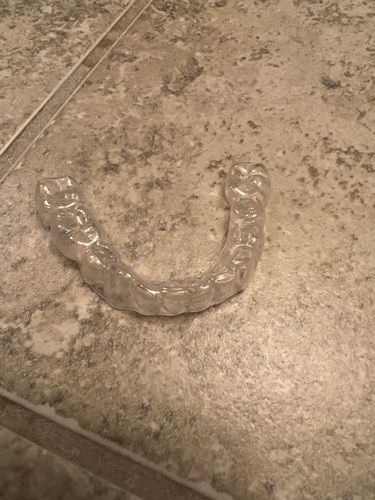 Customer photo review of Lower Teeth Retainer