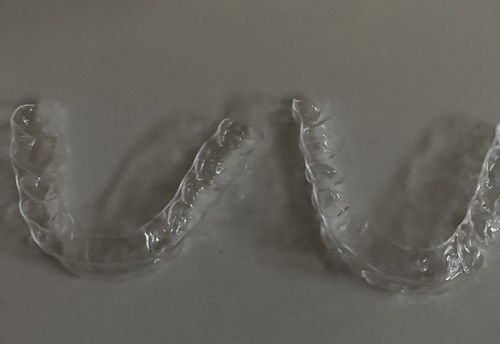 Customer photo review of Upper and Lower Retainers Set