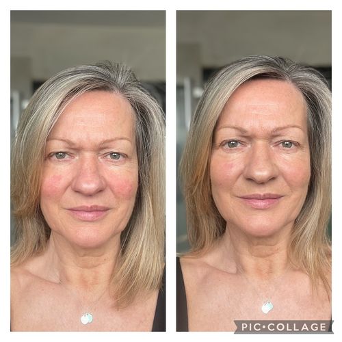 Customer photo review of Rosalique 3 in 1 Anti-Redness Miracle Formula SPF50