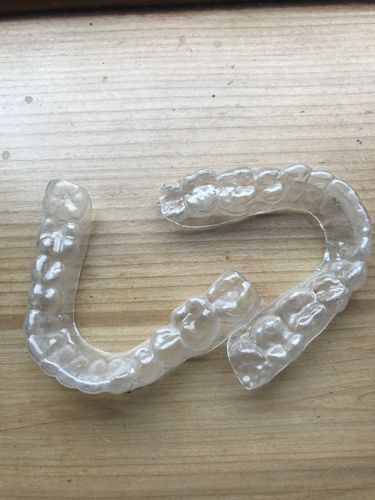 Customer photo review of SleepPro Retainers