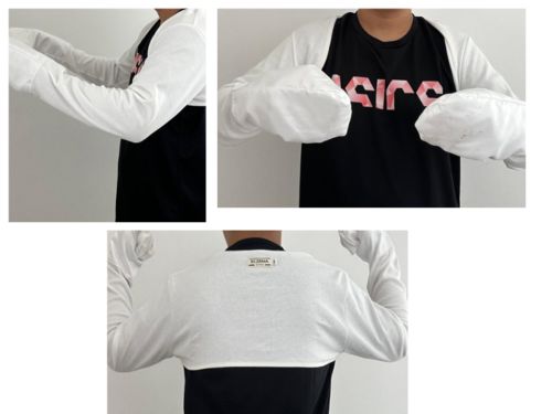 Customer photo review of Eczema Scratch Mitten