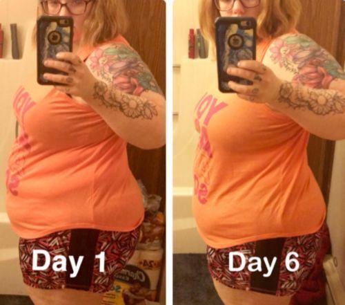 Customer photo review of Perfect Detox Slimming Patch(Limited Time Discount 🔥 Last Day)