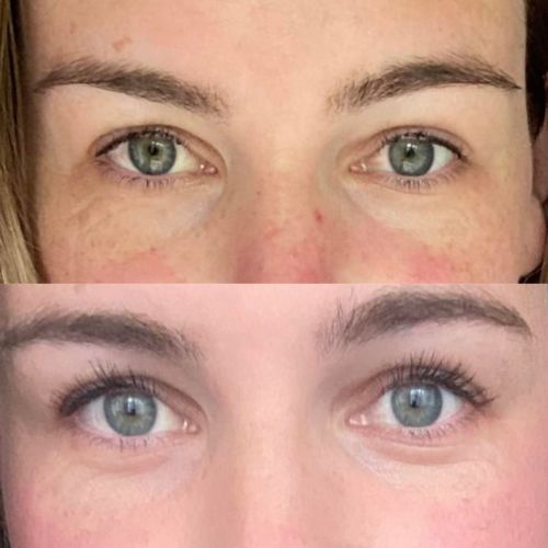 Customer photo review of LASH GROWTH SERUM