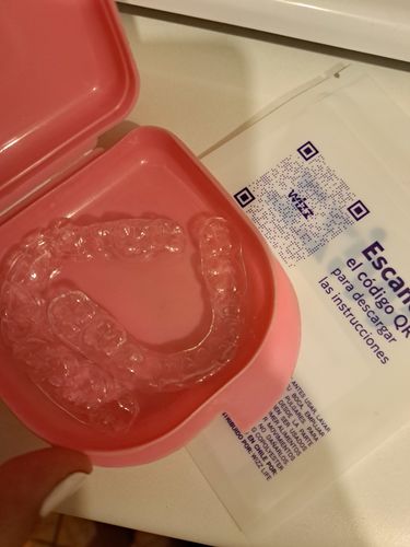 Customer photo review of Retenedores