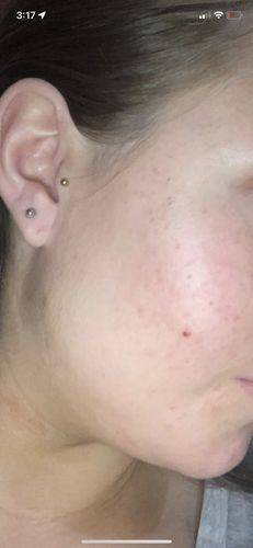 Customer photo review of Gut Maintain - 2 Months Supply