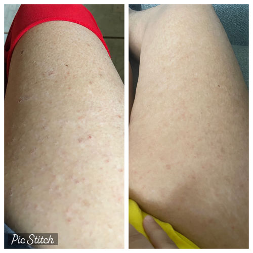 Customer photo review of Cinnamon Sea Moss Gel
