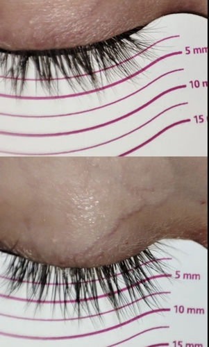 Customer photo review of Toplash eyelash and eyebrow growth serum — 3ml