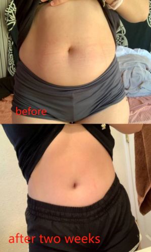 Customer photo review of Hot sale - Natural Belly Drainage Ginger Oil