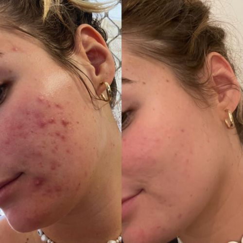 Customer photo review of Intermediate Reset Program
