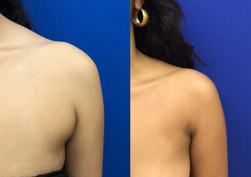 Customer photo review of Hot sale - Natural Belly Drainage Ginger Oil