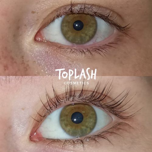 Customer photo review of Toplash eyelash and eyebrow growth serum — 3ml