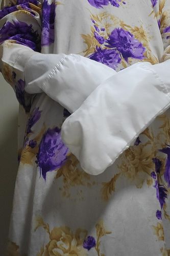 Customer photo review of Eczema Scratch Mitten