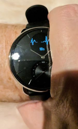 Kundenbewertung mit Foto zu Withings ScanWatch