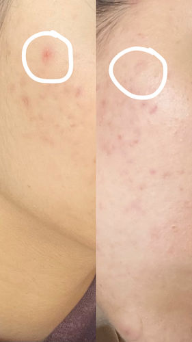 Customer photo review of Ginseng Essence Water