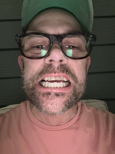 Customer photo review of Extra Impression Putty (STRONGLY RECOMMENDED)