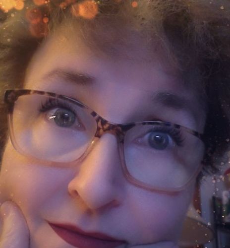 Customer photo review of Premium Onecompress™ Gloves (4 Pack)