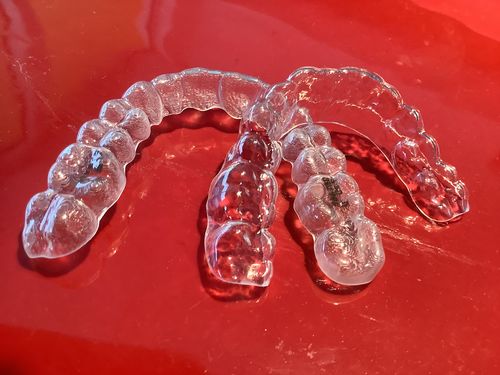 Customer photo review of Lower Teeth Retainer