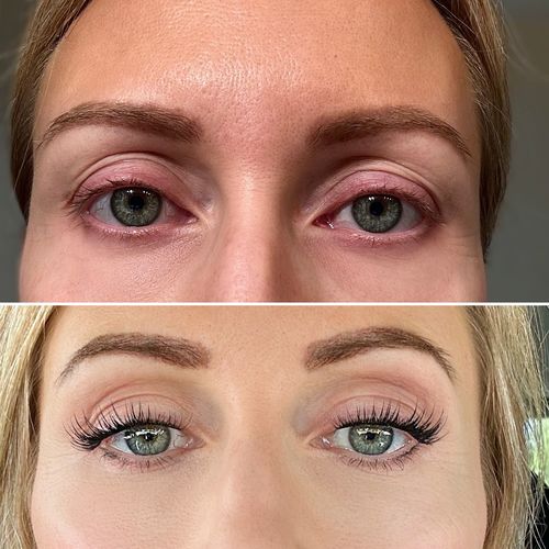 Customer photo review of Control Kit