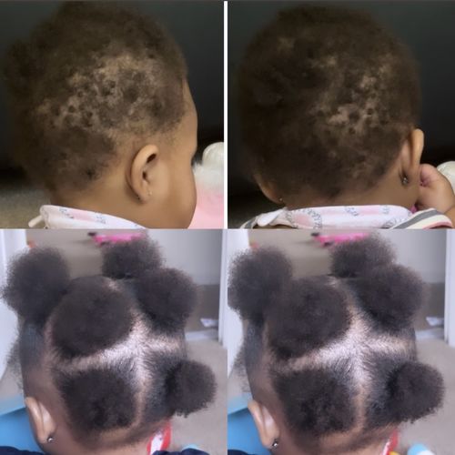 Customer photo review of Kid's Hair Growth Scalp Stimulator