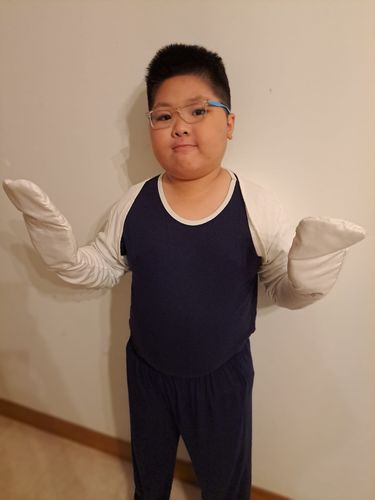 Customer photo review of Eczema Scratch Mitten