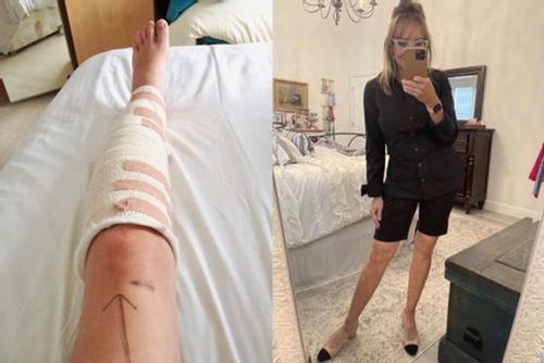 Customer photo review of CC™ Perfectx Joint And Bone Therapy Cream(Limited Time Discount 🔥 Last Day)