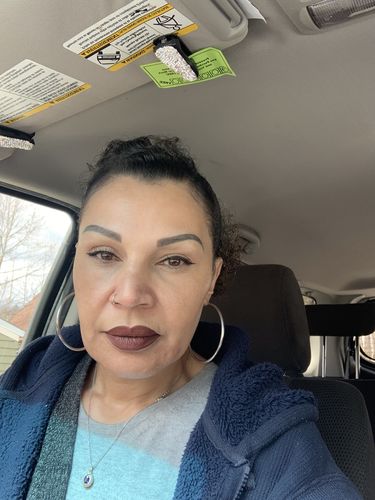 Customer photo review of SkinFix: Hydrafacial