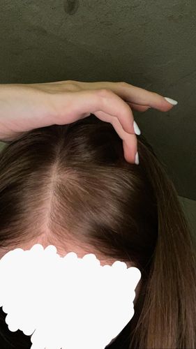 Customer photo review of REBALANCING Shampoo