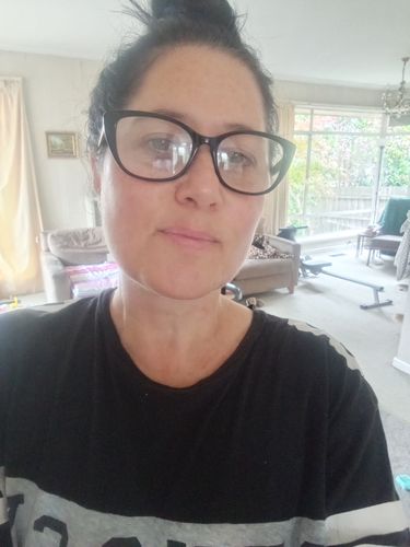 Customer photo review of SEA BUCKTHORN SERUM