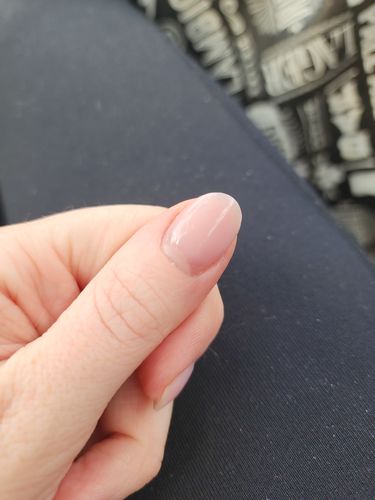 Customer photo review of His & Hers Collagen Bundle