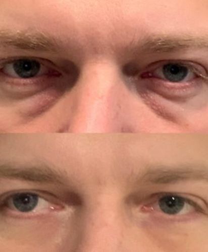 Customer photo review of Pedia™ Advanced Collagen Boost Anti Aging Serum ( Limited time discount Last 30 minutes)