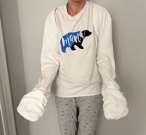 Customer photo review of Eczema Scratch Mitten