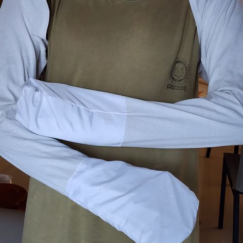 Customer photo review of Eczema Scratch Mitten