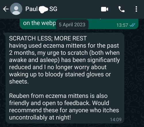 Customer photo review of Eczema Scratch Mitten