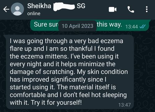 Customer photo review of Eczema Scratch Mitten